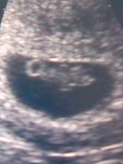 7wks5dys.jpg