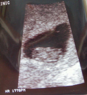 9wks2dys.jpg