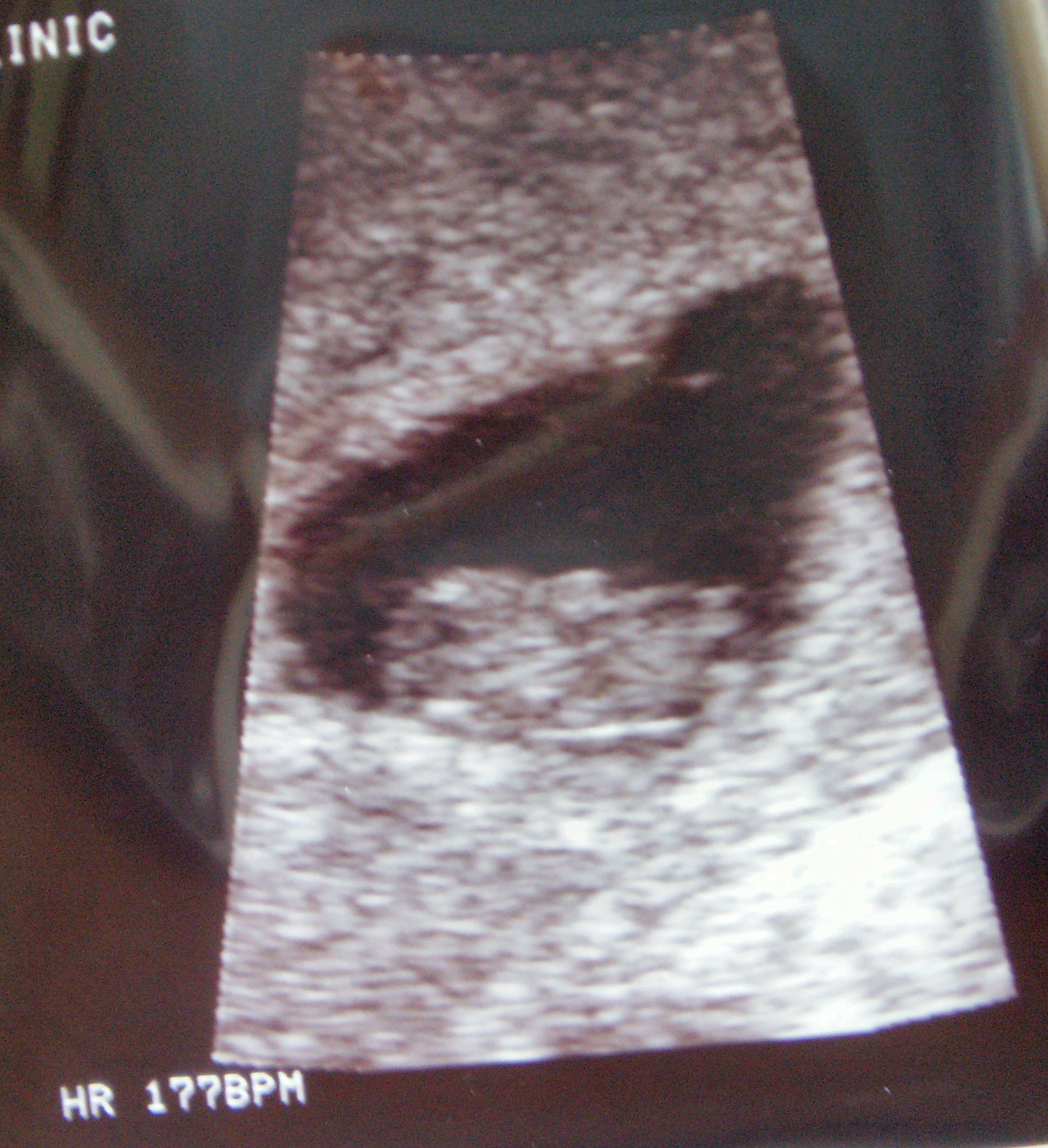 9wks2dys.jpg